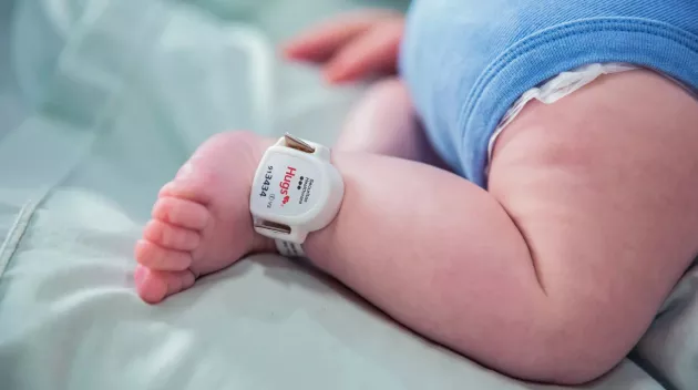 Hugs infant protection tag and band on infant's ankle. Securitas Healthcare.