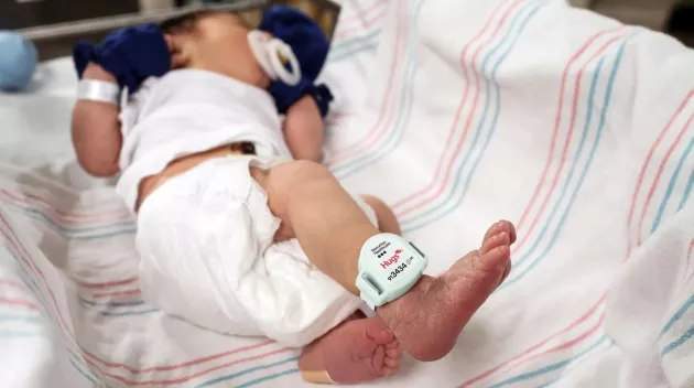 Hugs Infant protection band on a newborn baby. Securitas Healthcare. 