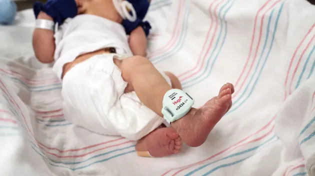 Hugs Infant protection band on a newborn baby. Securitas Healthcare. 