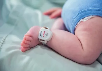 Hugs infant protection tag and band on infant's ankle. Securitas Healthcare.