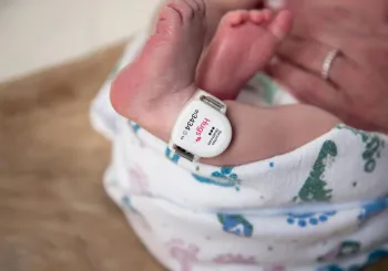 Hugs tag worn on newborn ankle. Securitas Healthcare